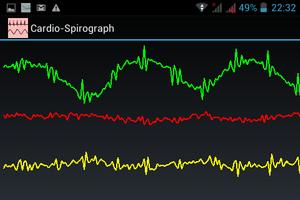 Cardio Spirograph F screenshot 1