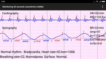 Cardio Spirograph F screenshot 2