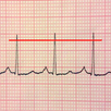 ECG Reader 2 free APK