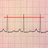 ECG Reader 2 free APK