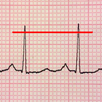 ECG Reader free APK