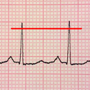 ECG Reader free APK