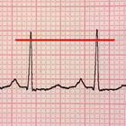 ECG Reader free ícone