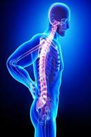 Upper & Lower Back Pain Relief الملصق