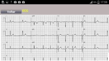 Arritmias Cardíacas 5.0 screenshot 2