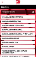IESB - Radiologia Odontológica capture d'écran 1