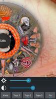 Eye Diagnosis ảnh chụp màn hình 3