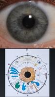 Eye Diagnosis Ekran Görüntüsü 2