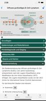 Non-Hodgkin-Lymphom onkowissen syot layar 1