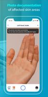 Eczema App | Nia capture d'écran 1