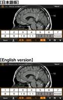 Interactive CT and MRI Anatomy ภาพหน้าจอ 3