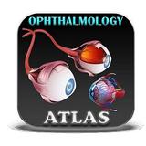 Ophthalmology Atlas