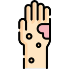 Eczema 101 Audio Guide Zeichen