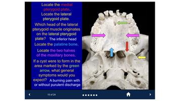 Head & Neck Anatomy-SecondLook تصوير الشاشة 1