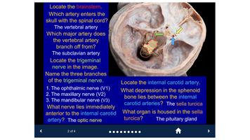 Head & Neck Anatomy-SecondLook اسکرین شاٹ 2