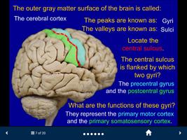 Neuroanatomy - SecondLook capture d'écran 1