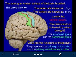 Neuroanatomy - SecondLook Screenshot 1