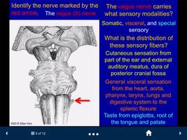 Neuroanatomy Lite - SecondLook capture d'écran 3