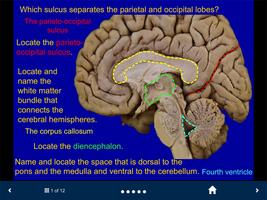 برنامه‌نما Neuroanatomy Lite - SecondLook عکس از صفحه