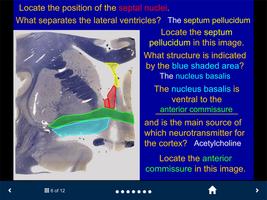 Neuroanatomy Lite - SecondLook ảnh chụp màn hình 2