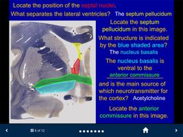 Neuroanatomy Lite - SecondLook ภาพหน้าจอ 2