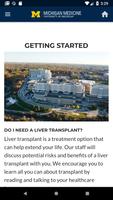 Liver Transplant Education poster