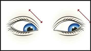 练习和眼睛提示 截图 3