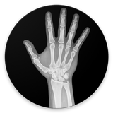 Bone age APK