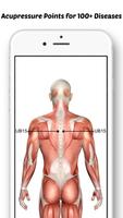 Acupressure تصوير الشاشة 2