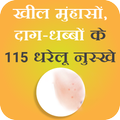 Kil Muhaso ke Gharelu Upay -किल मुहासो के घरलू उपय