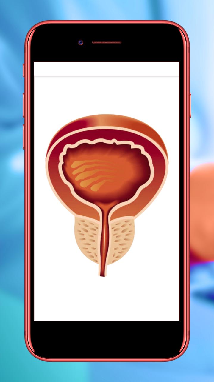 Prostatitis vietnam