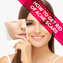 How to Get Rid of Acne Scars APK
