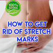 How To Get Rid Of Stretch Marks