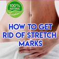 How To Get Rid Of Stretch Mark