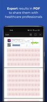 HeartScan ภาพหน้าจอ 1