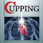 Cupping simgesi