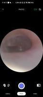 Dr.Earwax captura de pantalla 1