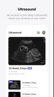 Momitalk: Pregnancy Ultrasound ảnh chụp màn hình 3