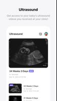 Momitalk: Pregnancy Ultrasound تصوير الشاشة 3