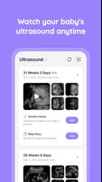 Momitalk: Pregnancy Ultrasound screenshot 3