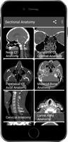 Radiology CT And MRI Anatomy Screenshot 2