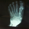 Xray Scanner APK