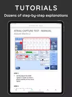 iPacemaker AI Follow-up ภาพหน้าจอ 7