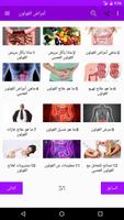 پوستر علاج أمراض القولون