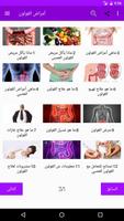 علاج أمراض القولون Affiche