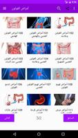 علاج أمراض القولون capture d'écran 1