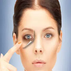 علاج الهالات السوداء
