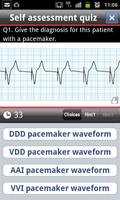 easy ECG training imagem de tela 1