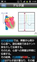 2 Schermata らくらく心電図トレーニング（英語モード付き）