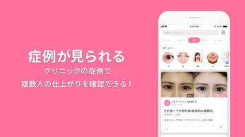 美容整形・美容医療の口コミ・予約アプリ 美容外科検索メイリー capture d'écran 1